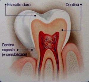 Sensibilidade Dentinária