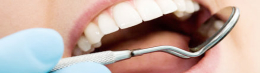 Implante Dental